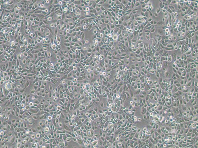 VK2/E6E7 Cell Complete Medium - 2