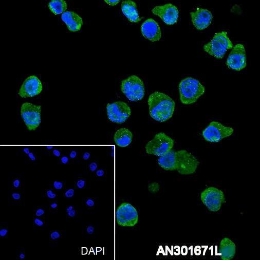 Recombinant TCL1 Monoclonal Antibody - small - 6