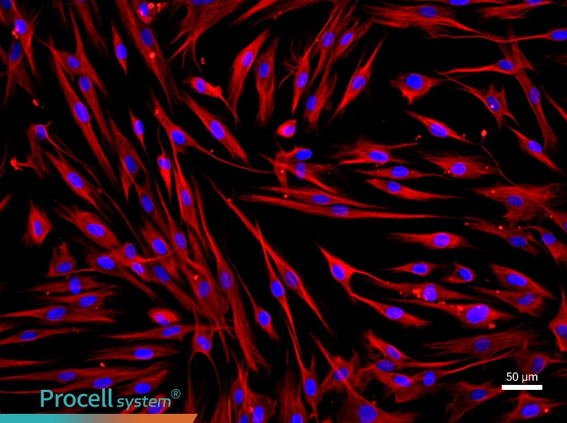 Human Bronchial Fibroblast Complete Medium - 1