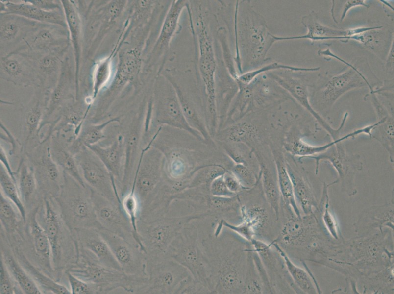 FTC-133 Cell Complete Medium - small - 5