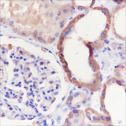 Recombinant GOT2 Monoclonal Antibody - 2