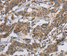 SYN2 Polyclonal Antibody - 2