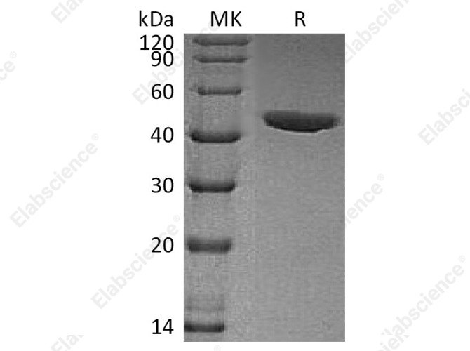 Recombinant Human CHI3L1/YKL40 Protein (His Tag) - 1