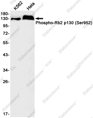 Recombinant Phospho-Rb2 p130 (Ser952) Monoclonal Antibody - 1