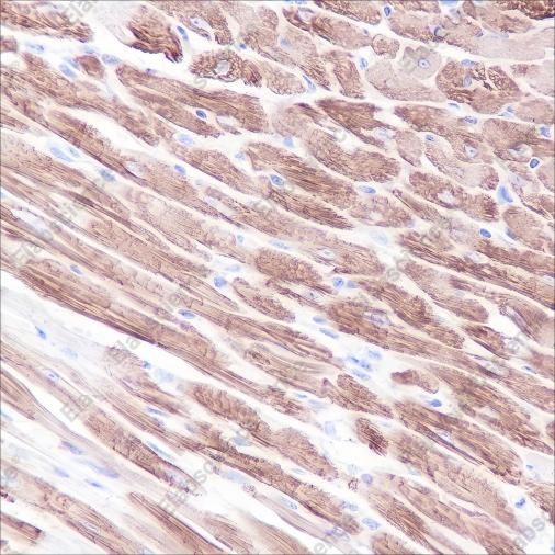 Recombinant Myosin Light Chain 3 Monoclonal Antibody - 3