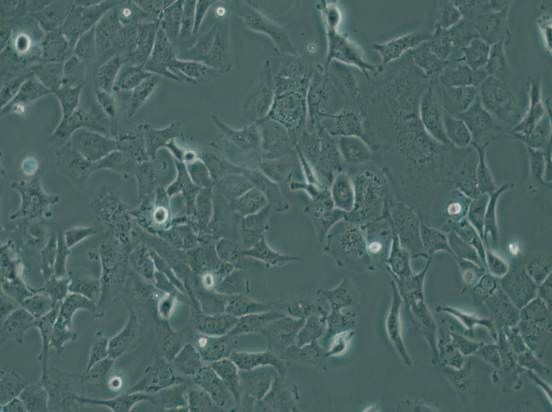 SK-OV-3 Cell Complete Medium - small - 5