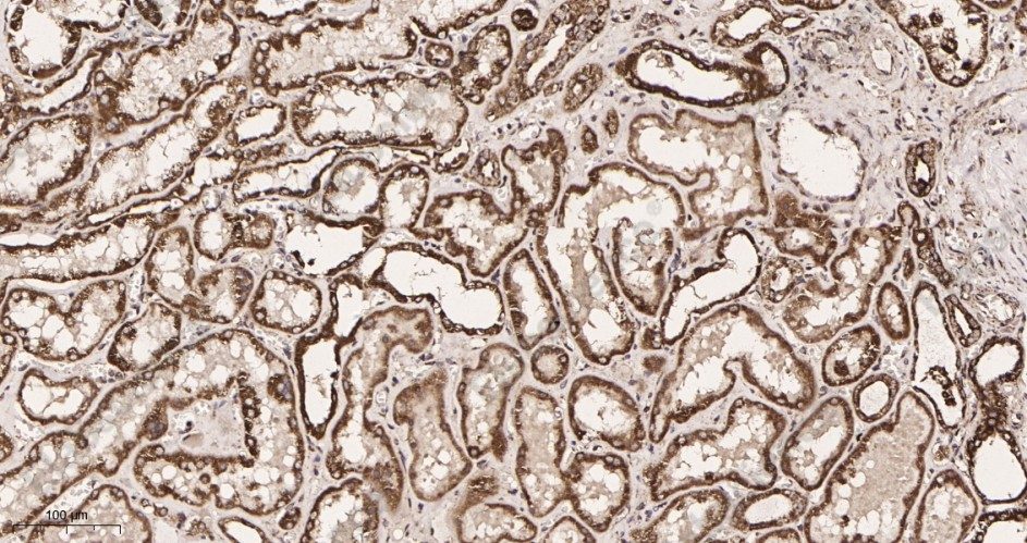 Recombinant Prohibitin Monoclonal Antibody - 2