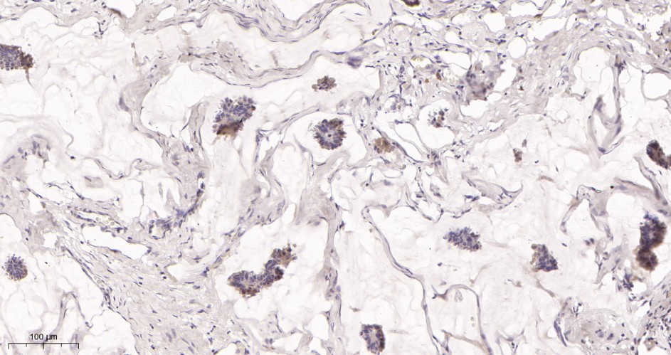 Recombinant ALIX Monoclonal Antibody - small - 2