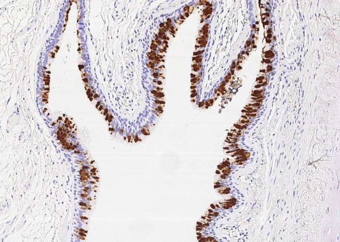 Recombinant BPIFB1/LPLUNC1 Monoclonal Antibody-searchlist-1