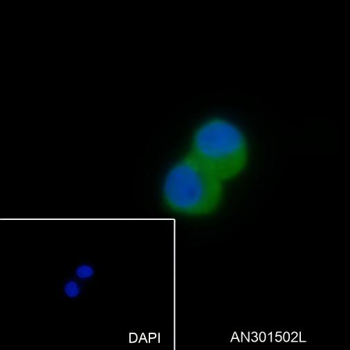 Recombinant CTEN Monoclonal Antibody - small - 4
