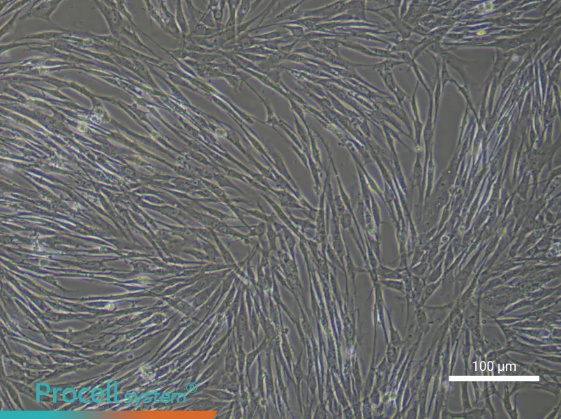 Human Renal Fibroblast Complete Medium - 1