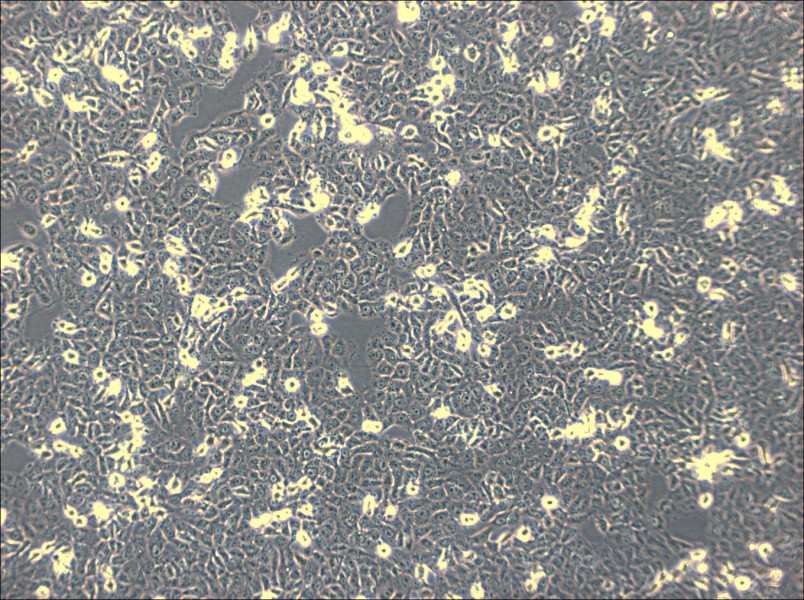 IOMM-Lee Cell Complete Medium - small - 3