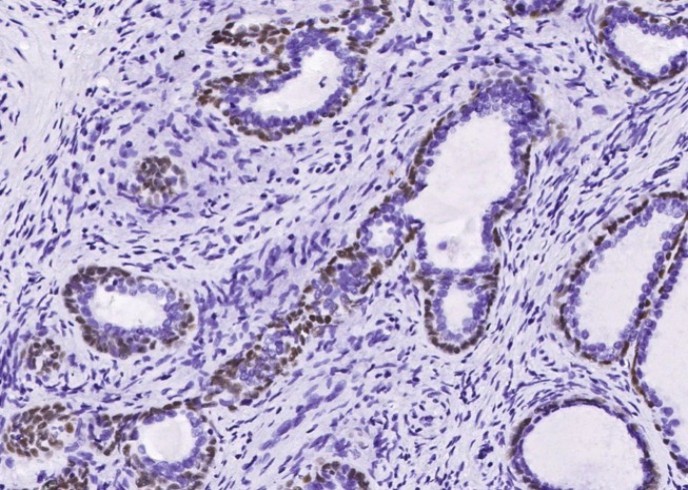 Recombinant p63(alpha) Monoclonal Antibody - small - 2