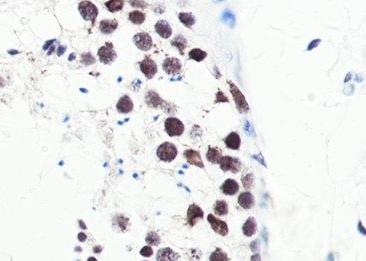 Recombinant PNKP Monoclonal Antibody-searchlist-3