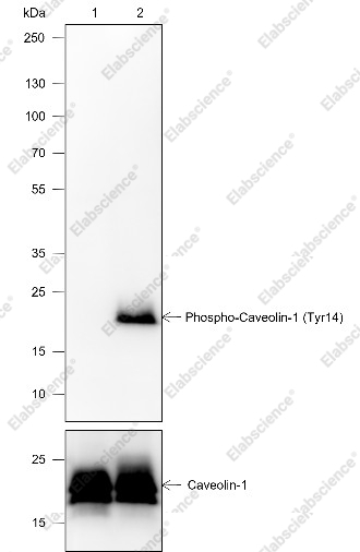 Recombinant Phospho-Caveolin-1 (Tyr14) Monoclonal Antibody - 1