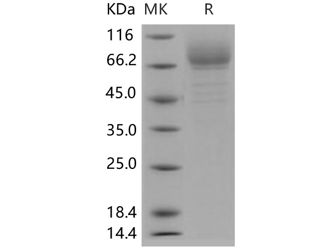 Recombinant Human CD200 Protein(His Tag)-产品推荐-1