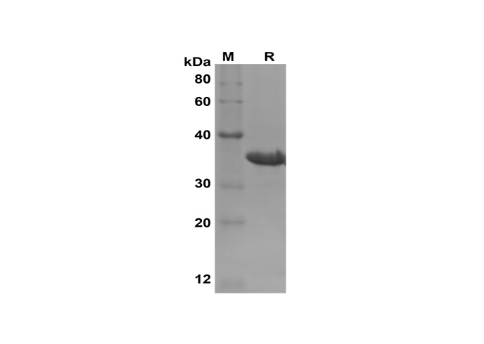 Recombinant Mouse IL-15 Protein(Sumo Tag)-产品推荐-1