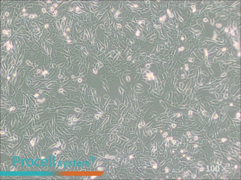 UM-UC-3 Cell Complete Medium - 3