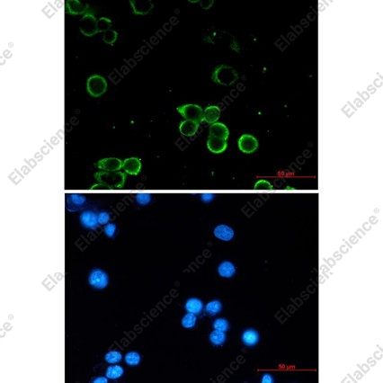 Recombinant Adenosine A1 Receptor Monoclonal Antibody - 2