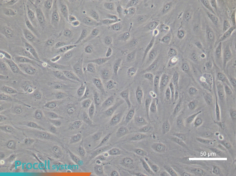 Human Cardiac Microvascular Endothelial Cell Complete Medium - 5