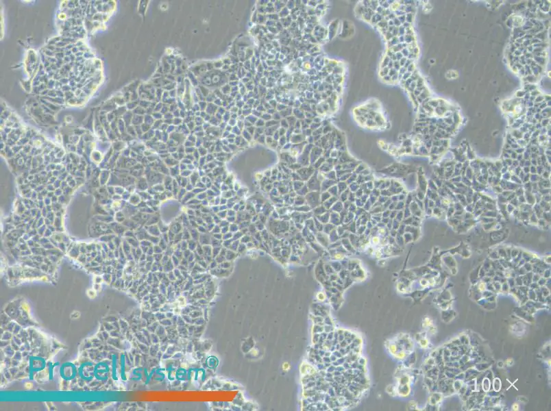 MCF-7-FLUC Cell Complete Medium - 2