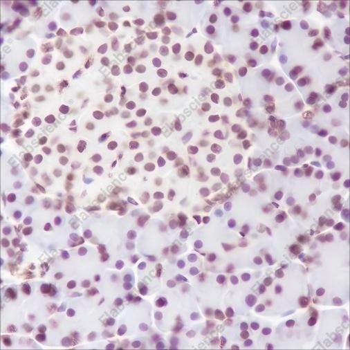 Recombinant Phospho-Cyclin D1 (Thr286) Monoclonal Antibody - 5