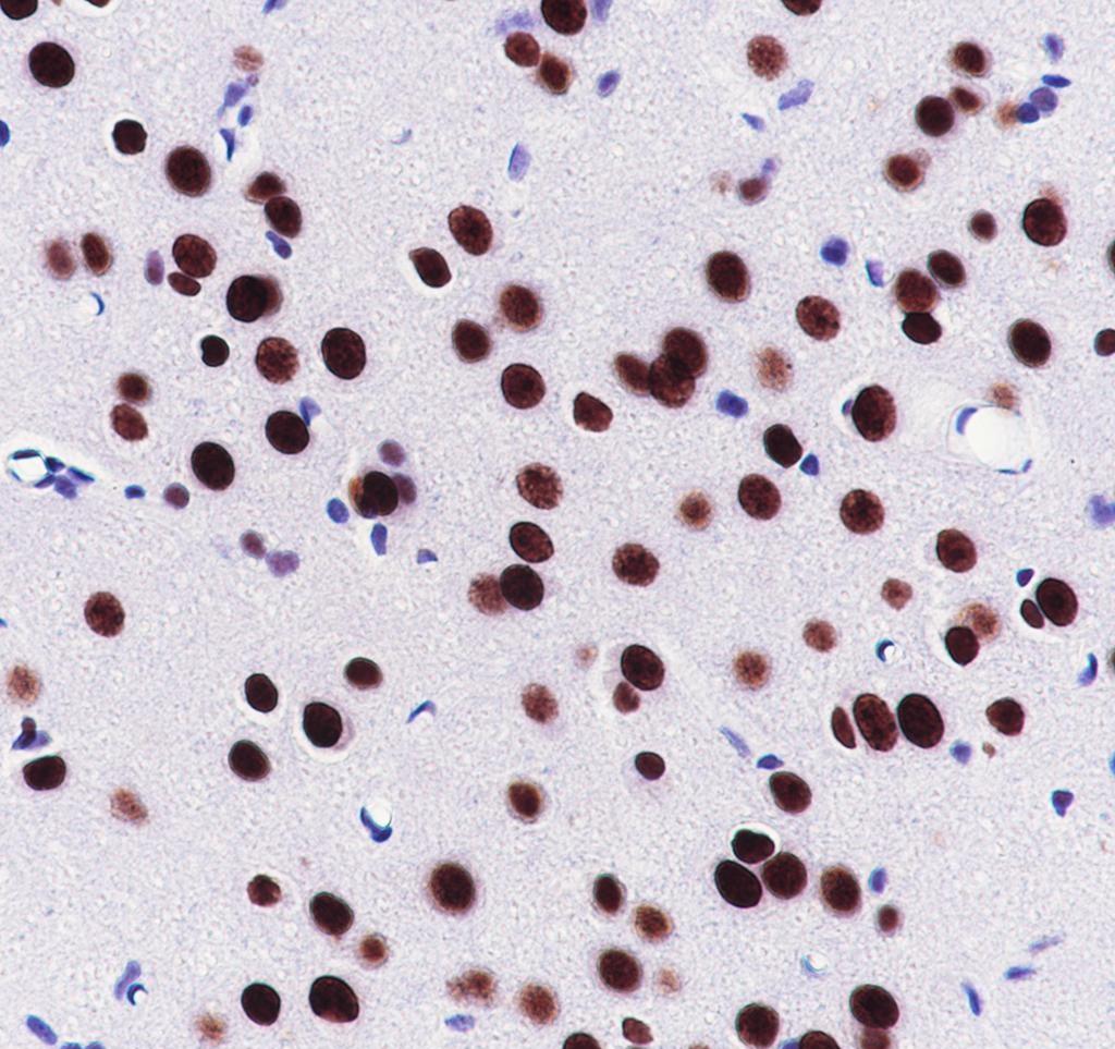 Recombinant Nucleolin Monoclonal Antibody - small - 5