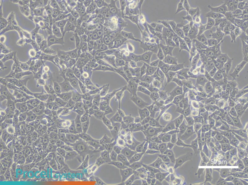 TC-1 [Mouse lung]TC-1 [Mouse lung] - 5