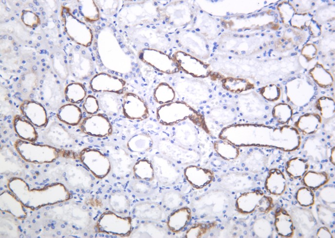 Recombinant PAI-1 Monoclonal Antibody-searchlist-1