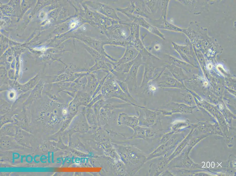 SK-LMS-1 Cell Complete Medium - 6