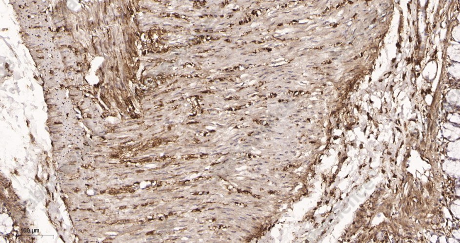 Recombinant LRP1 Monoclonal Antibody - 3