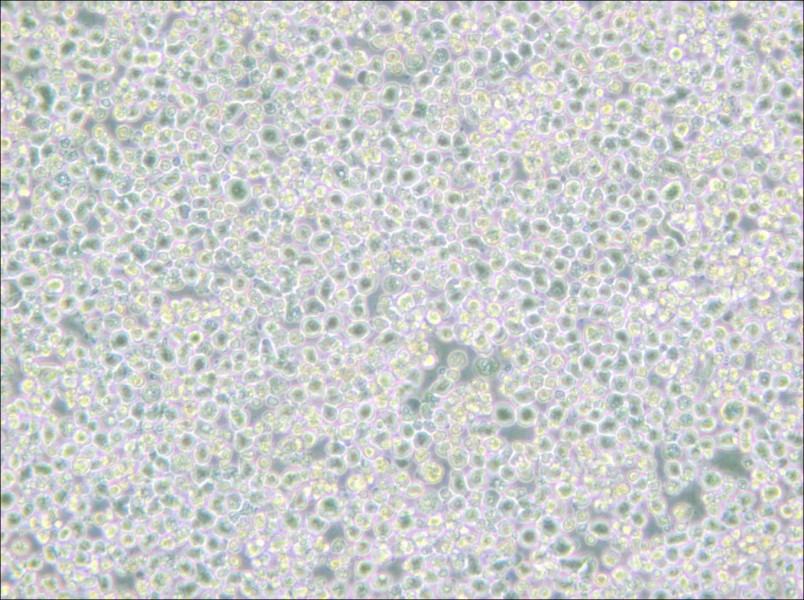 PC 61 5.3 [PC 61; PC 61.5.3] Cell Complete Medium - small - 4