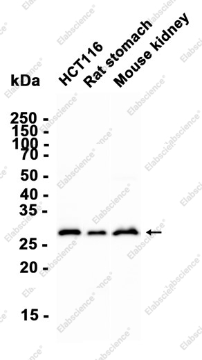 Recombinant GC1q R Monoclonal Antibody - 2
