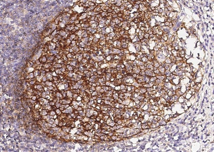 CD21 Monoclonal Antibody - small - 2