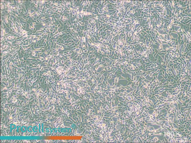 SUM159PT Cell Complete MediumSUM159PT Cell Complete Medium - 2
