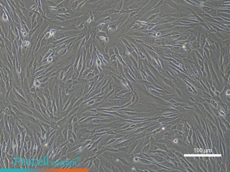 Human Intervertebral Disc Nucleus Pulposu (Primary cell immortalization) Cell Complete Medium - 2