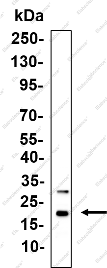 Recombinant Claudin-2 Monoclonal Antibody - 1