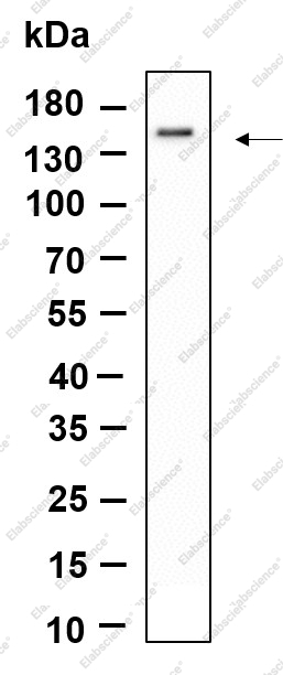 Recombinant SMC3 Monoclonal Antibody - 1