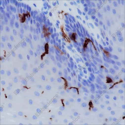 Recombinant CD1a Monoclonal Antibody - 1