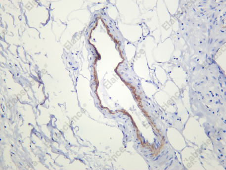 Recombinant TIMP-3 Monoclonal Antibody - 1