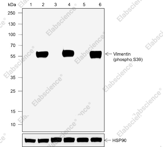 Recombinant Phospho-Vimentin (Ser39) Monoclonal Antibody - 1