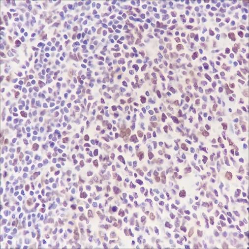 Recombinant DNMT1 Monoclonal Antibody - small - 3