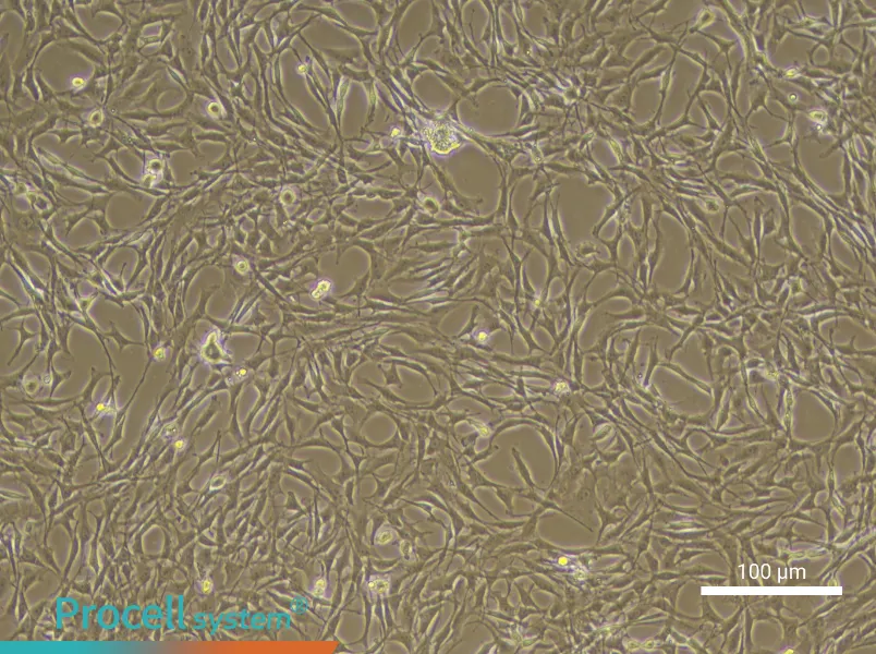 Rat Synovial Cell Complete Medium - 2