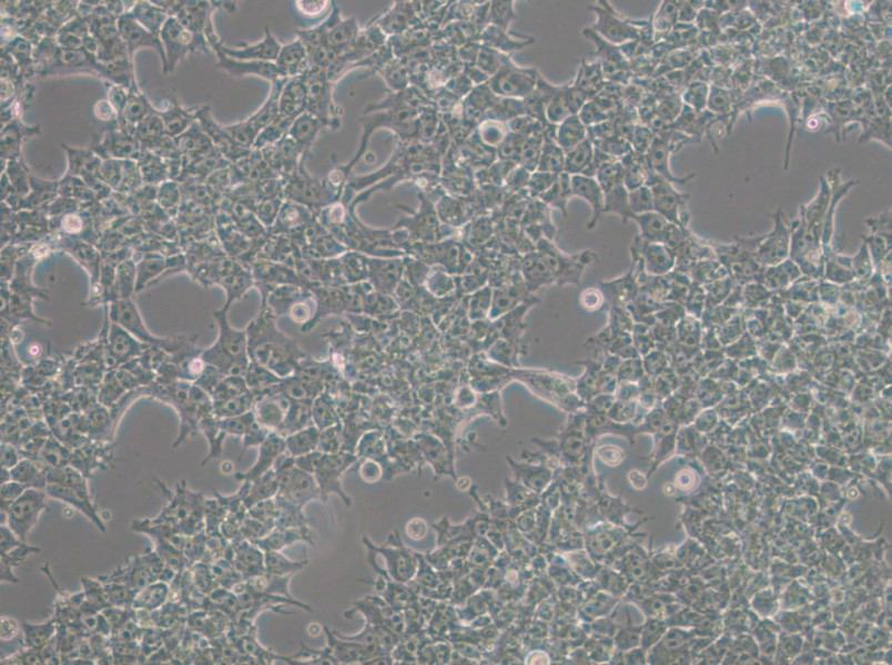 NCCIT Cell Complete Medium - 5