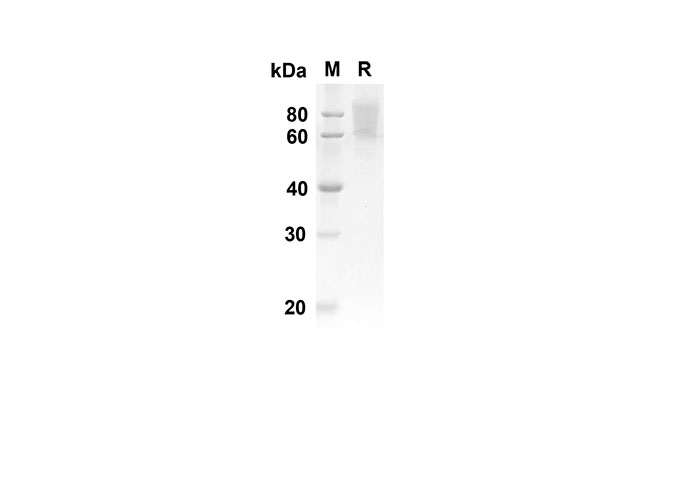 Recombinant Human IL22 Protein(Avi,His Tag)-产品推荐-1