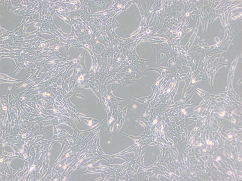 Renca [RenCa] Cell Complete Medium - small - 3