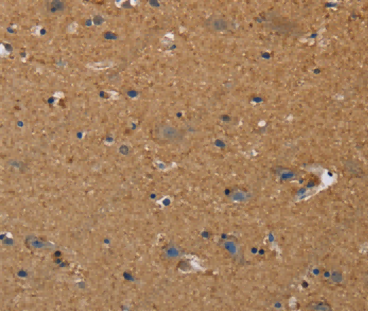 DDAH1 Polyclonal Antibody - 3
