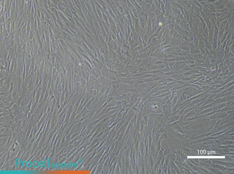 Human Bronchial Smooth Muscle Cell Complete Medium - 3
