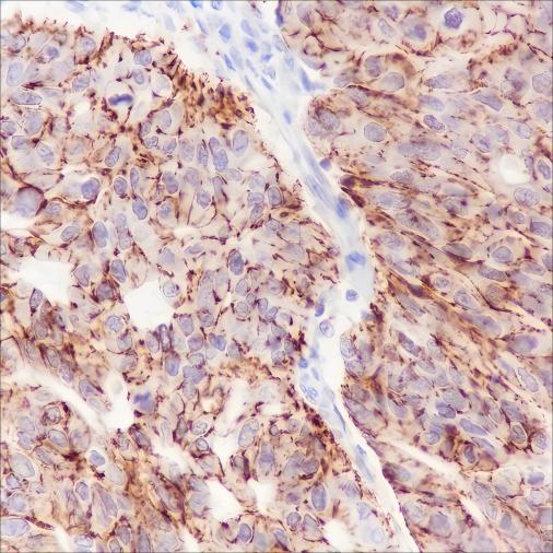 Recombinant Claudin-7 Monoclonal Antibody - small - 2