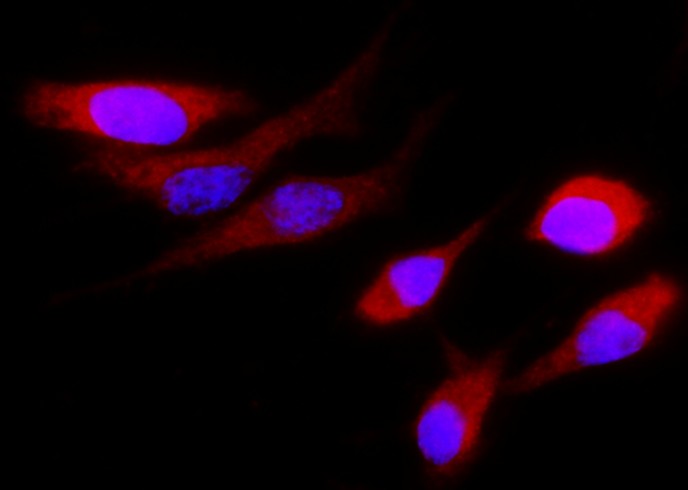Recombinant Cystatin S/CST4 Monoclonal Antibody-searchlist-1
